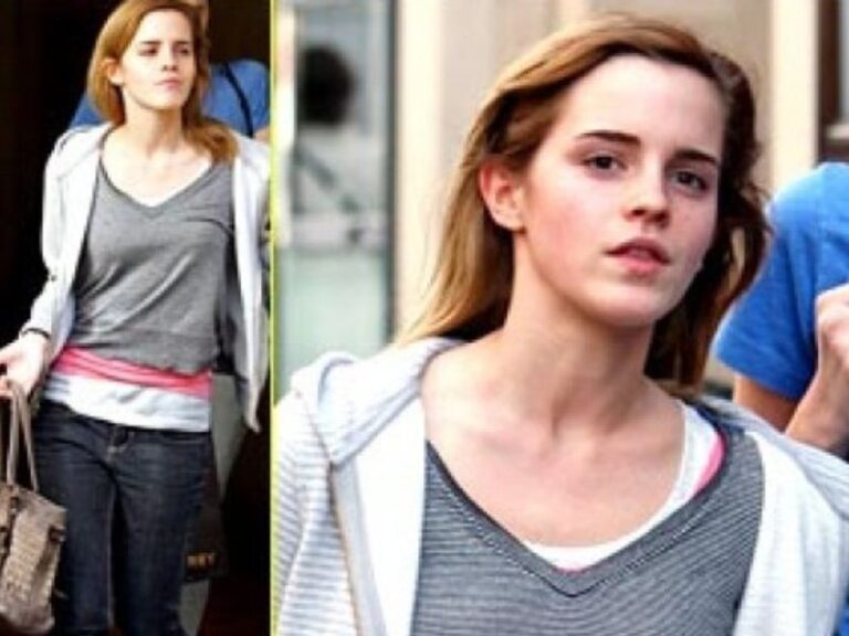 Amazing Photos of Emma Watson No Makeup | Apohair